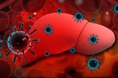 肝癌早期有三處痛