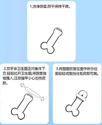 男士衛(wèi)生圈正確戴法圖片